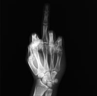 X-ray Fuck like Delvoye. S.Laurent