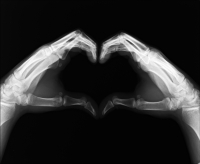 X-Ray heart Sébastien Laurent