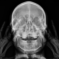 X ray Say S.Laurent